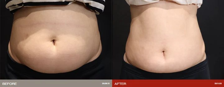 Weight management: before-and-after photographs supplied by Ollium Clinic